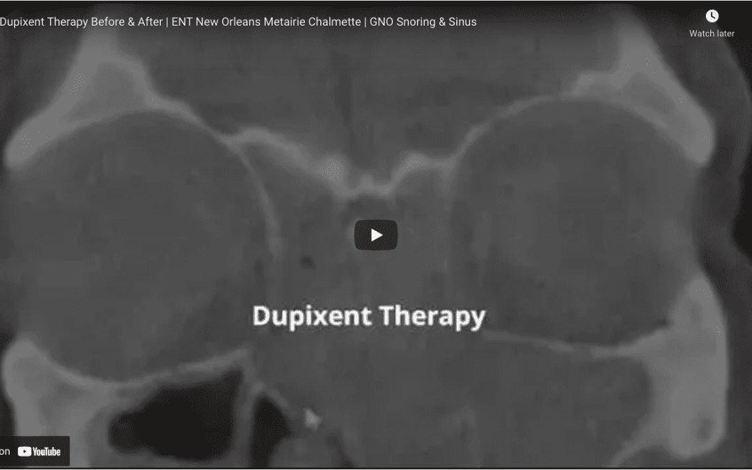Dupixent Injection Therapy at GNO Snoring & Sinus