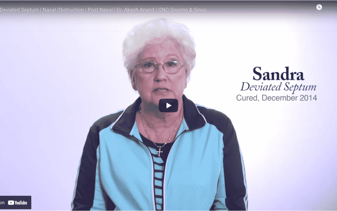 Sandra – Deviated Septum – Nasal Obstruction – Post Nasal