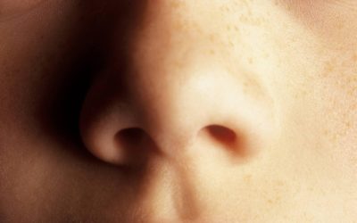 Is It Sinusitis? How Do You Treat It?